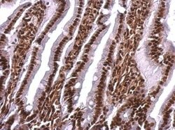 Invitrogen SAFB Polyclonal Antibody 100 &mu;L | Buy Online | Invitrogen&trade; | Fisher Scientific
