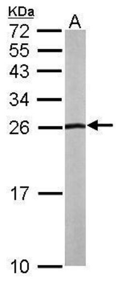 Invitrogen NHERF2 Polyclonal Antibody 100 &mu;L; Unconjugated:Antibodies,