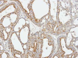 Invitrogen COX5B Polyclonal Antibody 100 &mu;L; Unconjugated:Antibodies,