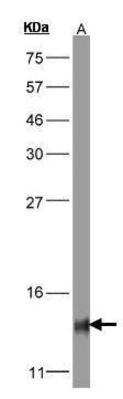 Invitrogen COX5B Polyclonal Antibody 100 &mu;L; Unconjugated:Antibodies,