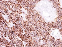 Invitrogen COX4 Polyclonal Antibody 100 &mu;L; Unconjugated:Antibodies,