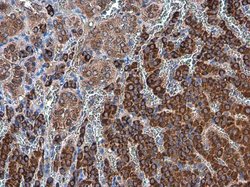 Invitrogen ODC1 Polyclonal Antibody 100 &mu;L | Buy Online | Invitrogen&trade; | Fisher Scientific