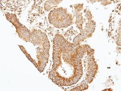 Invitrogen Septin-7 Polyclonal Antibody 100 &mu;L; Unconjugated:Antibodies,