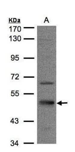 Invitrogen Septin-7 Polyclonal Antibody 100 &mu;L; Unconjugated:Antibodies,
