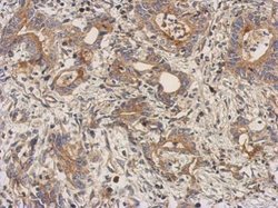 Invitrogen LEFTY2 Polyclonal Antibody 100 &mu;L; Unconjugated:Antibodies,