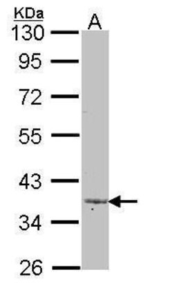 Invitrogen LEFTY2 Polyclonal Antibody 100 &mu;L; Unconjugated:Antibodies,