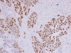 Invitrogen PAX8 Polyclonal Antibody 100 &mu;L; Unconjugated:Antibodies,