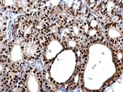 Invitrogen PAX8 Polyclonal Antibody 100 &mu;L; Unconjugated:Antibodies,