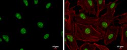 Invitrogen ADAR1 Polyclonal Antibody 100 &mu;L; Unconjugated:Antibodies,