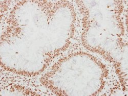 Invitrogen ADAR1 Polyclonal Antibody 100 &mu;L; Unconjugated:Antibodies,