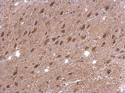 Invitrogen DAP5 Polyclonal Antibody 100 &mu;L | Buy Online | Invitrogen&trade; | Fisher Scientific