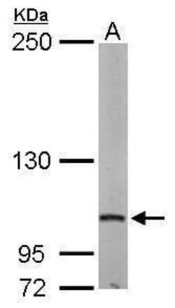 Invitrogen DAP5 Polyclonal Antibody 100 &mu;L | Buy Online | Invitrogen&trade; | Fisher Scientific