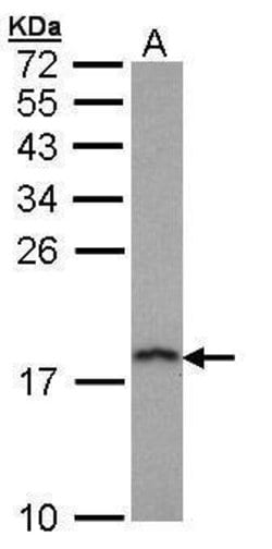Invitrogen PFDN5 Polyclonal Antibody 100 &mu;L; Unconjugated:Antibodies,