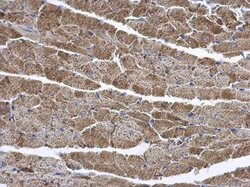 Invitrogen ENTPD6 Polyclonal Antibody 100 &mu;L | Buy Online | Invitrogen&trade; | Fisher Scientific