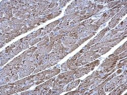 Invitrogen UQCRC1 Polyclonal Antibody 100 μL; Unconjugated:Antibodies,
