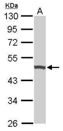 Invitrogen UQCRC1 Polyclonal Antibody 100 μL; Unconjugated:Antibodies,