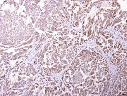 Invitrogen Endomucin Polyclonal Antibody 100 μL; Unconjugated:Antibodies,