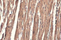 Invitrogen alpha-Cardiac Actin Polyclonal Antibody 100 &mu;L; Unconjugated:Antibodies,
