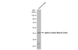 Invitrogen alpha-Cardiac Actin Polyclonal Antibody 100 &mu;L; Unconjugated:Antibodies,