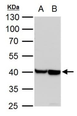 Invitrogen alpha-Cardiac Actin Polyclonal Antibody 100 &mu;L; Unconjugated:Antibodies,