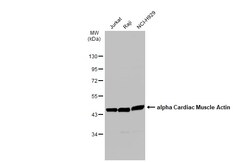 Invitrogen alpha-Cardiac Actin Polyclonal Antibody 100 &mu;L; Unconjugated:Antibodies,