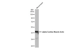 Invitrogen alpha-Cardiac Actin Polyclonal Antibody 100 &mu;L; Unconjugated:Antibodies,