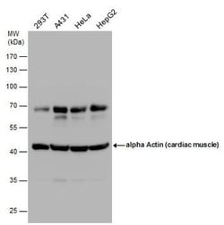 Invitrogen alpha-Cardiac Actin Polyclonal Antibody 100 &mu;L; Unconjugated:Antibodies,