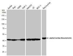 Invitrogen alpha-Cardiac Actin Polyclonal Antibody 100 &mu;L; Unconjugated:Antibodies,