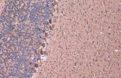 Invitrogen GAD67 Polyclonal Antibody 100 &mu;L; Unconjugated:Antibodies,