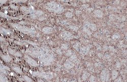 Invitrogen GAD67 Polyclonal Antibody 100 &mu;L; Unconjugated:Antibodies,