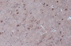Invitrogen GAD67 Polyclonal Antibody 100 &mu;L; Unconjugated:Antibodies,