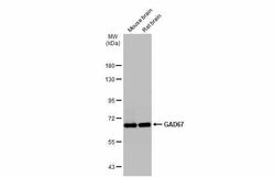 Invitrogen GAD67 Polyclonal Antibody 100 &mu;L; Unconjugated:Antibodies,