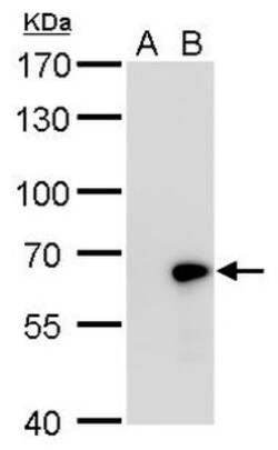 Invitrogen GAD67 Polyclonal Antibody 100 &mu;L; Unconjugated:Antibodies,