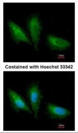 Invitrogen PRKCSH Polyclonal Antibody 100 &mu;L; Unconjugated:Antibodies,