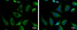 Invitrogen PRKCSH Polyclonal Antibody 100 &mu;L; Unconjugated:Antibodies,