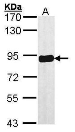 Invitrogen PRKCSH Polyclonal Antibody 100 &mu;L; Unconjugated:Antibodies,