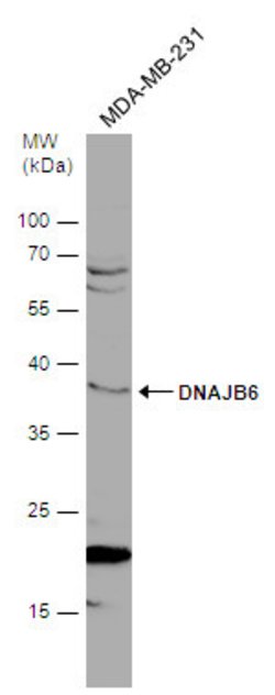 Invitrogen DNAJB6 Polyclonal Antibody 100 &mu;L; Unconjugated:Antibodies,