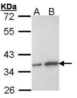 Invitrogen OTUB1 Polyclonal Antibody 100 &mu;L; Unconjugated:Antibodies,