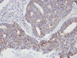 Invitrogen p21 ARC Polyclonal Antibody 100 &mu;L; Unconjugated:Antibodies,