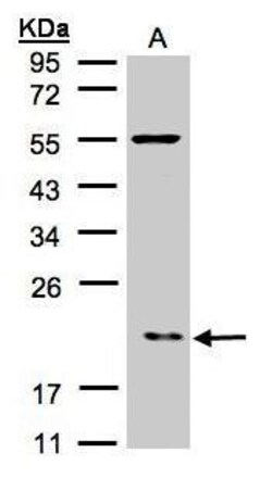 Invitrogen p21 ARC Polyclonal Antibody 100 &mu;L; Unconjugated:Antibodies,