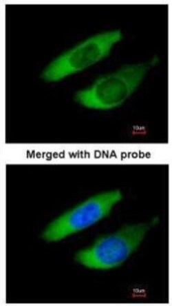 Invitrogen ARPC2 Polyclonal Antibody 100 &mu;L; Unconjugated:Antibodies,