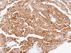 Invitrogen ARPC2 Polyclonal Antibody 100 &mu;L; Unconjugated:Antibodies,
