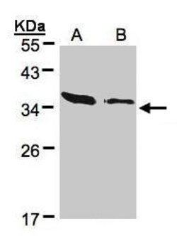 Invitrogen ARPC2 Polyclonal Antibody 100 &mu;L; Unconjugated:Antibodies,