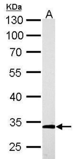 Invitrogen ARPC2 Polyclonal Antibody 100 &mu;L; Unconjugated:Antibodies,