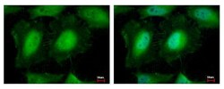 Invitrogen eIF3k Polyclonal Antibody 100 &mu;L; Unconjugated:Antibodies,