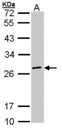 Invitrogen eIF3k Polyclonal Antibody 100 &mu;L; Unconjugated:Antibodies,