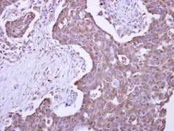 Invitrogen MLEC Polyclonal Antibody 100 &mu;L; Unconjugated:Antibodies,