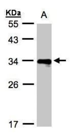 HLA-DR beta Polyclonal Antibody, Invitrogen&trade; 100 &mu;L; Unconjugated 