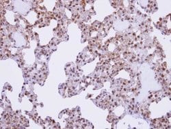 Invitrogen AKAP17A Polyclonal Antibody 100 &mu;L; Unconjugated:Antibodies,