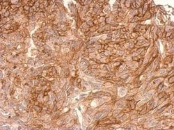 Invitrogen ADAMTSL2 Polyclonal Antibody 100 &mu;L; Unconjugated:Antibodies,